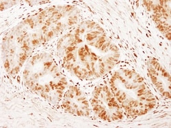 FoxK1 Antibody, Novus Biologicals 0.1mL; Unlabeled:Antibodies, Polyclonal
